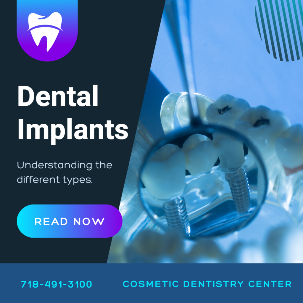 Understanding the Different Types of Dental Implants Cosmetic