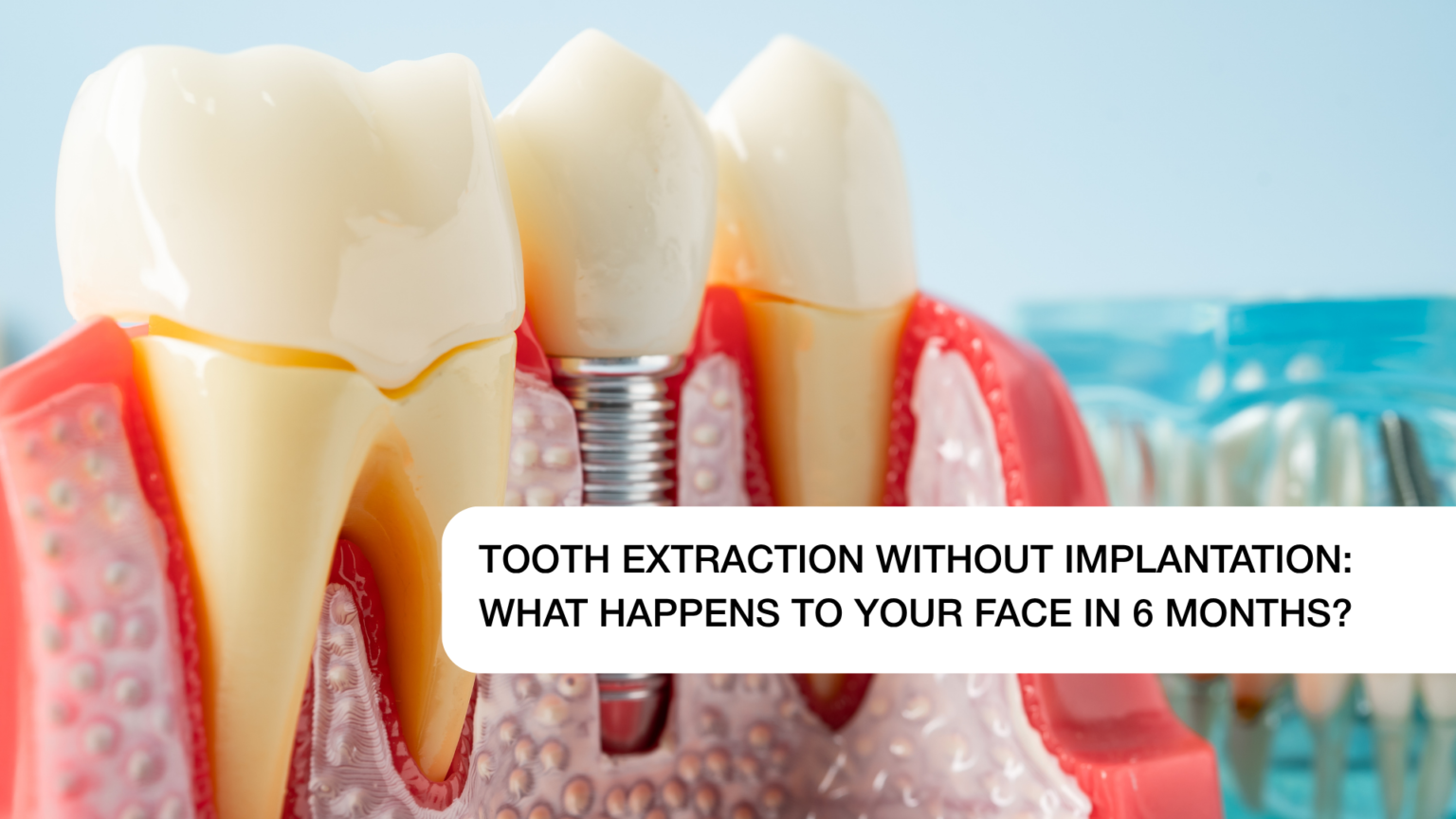 Tooth Extraction Without Implantation: What Happens to Your Face After ...
